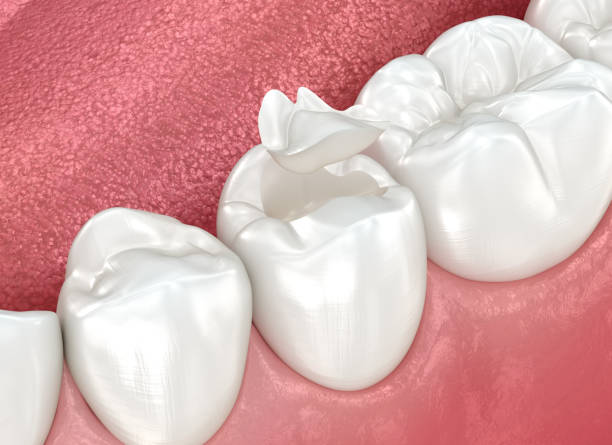 Our Range of Dental Services in Concord, CA